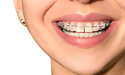 Orthodontist Marketing